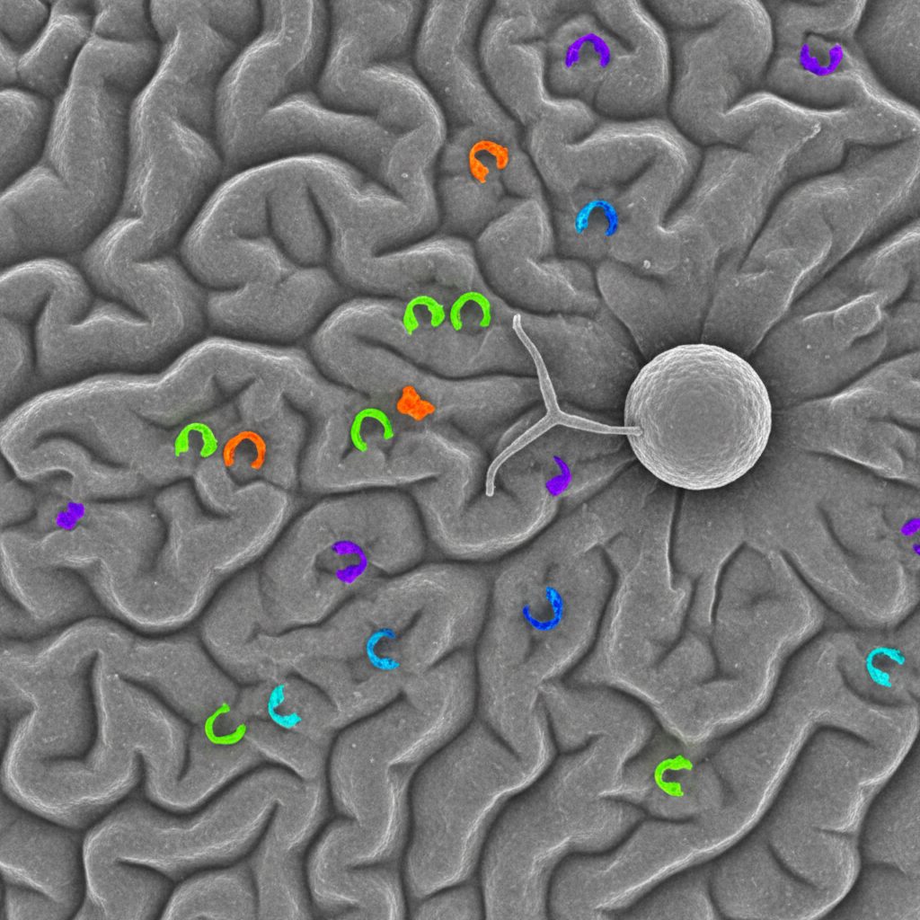 Zika Virus-Derived Peptides ZIKV Peptide HLA T-Cell Interaction